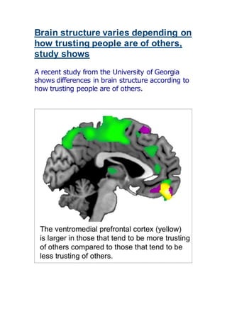 Brain structure varies depending on
how trusting people are of others,
study shows
A recent study from the University of Georgia
shows differences in brain structure according to
how trusting people are of others.
 
