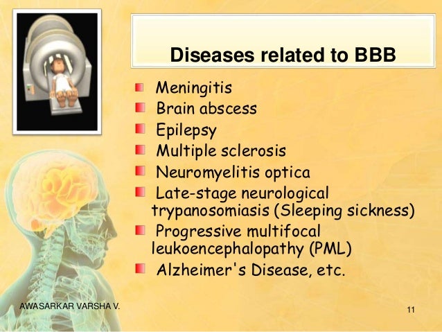 Brain targeted drug delivery system Brain targeted drug delivery system