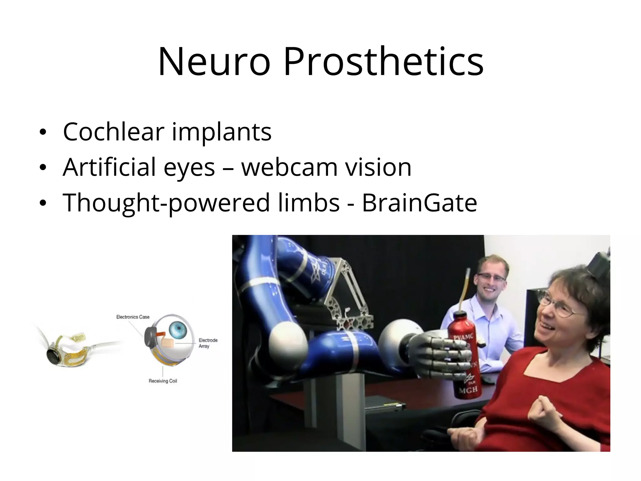 Neuro Prosthetics
•  Cochlear implants
•  Artiﬁcial eyes – webcam vision
•  Thought-powered limbs - BrainGate
 