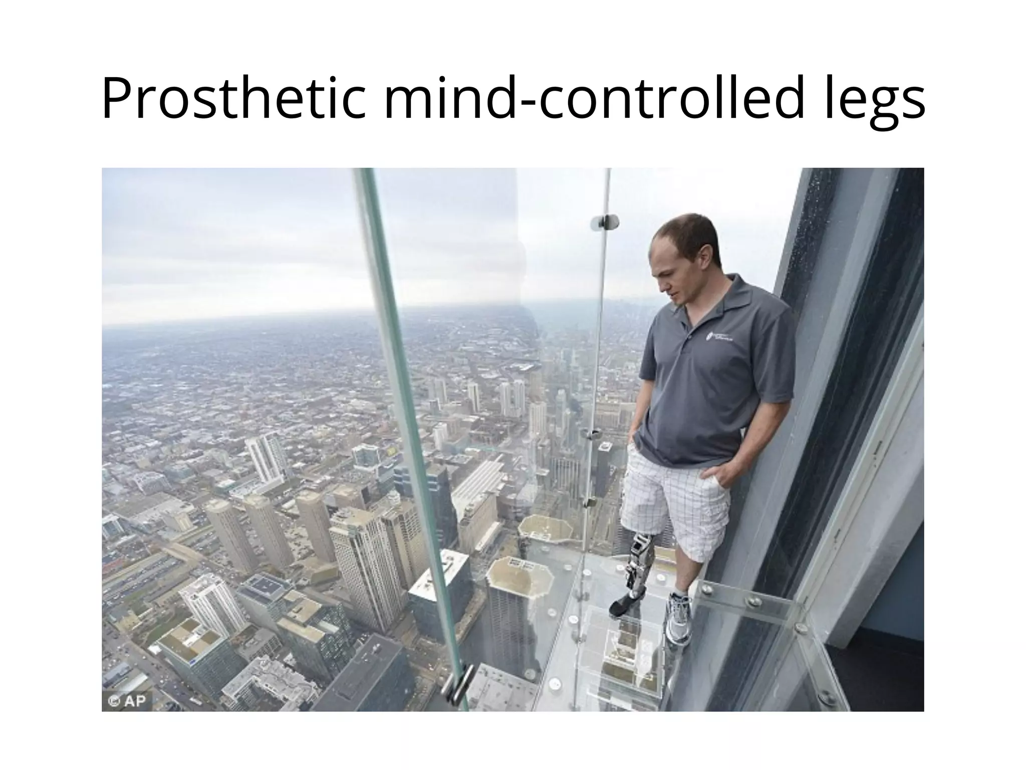 Prosthetic mind-controlled legs
 