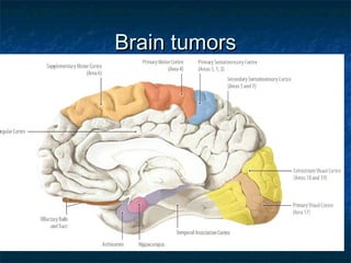 Brain tumorsBrain tumors
 