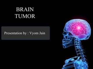 BRAIN
TUMOR
Presentation by : Vyom Jain
 