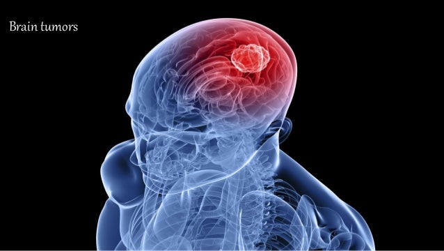 Brain tumor imaging pdf reader