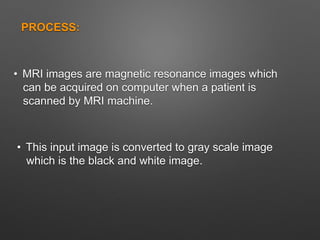 PROCESS:
• MRI images are magnetic resonance images which
can be acquired on computer when a patient is
scanned by MRI machine.
• This input image is converted to gray scale image
which is the black and white image.
 