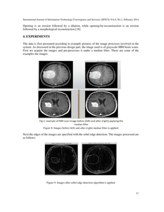 Brain tumor detection and localization in magnetic resonance imaging | PDF