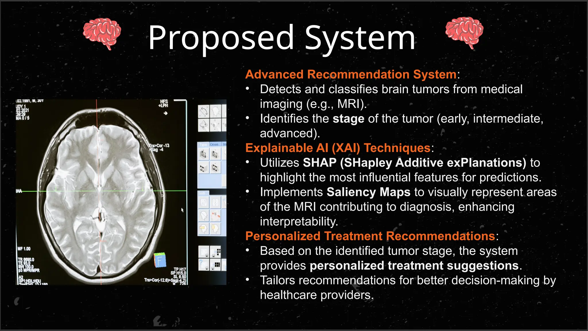 brain tumor detection along with explainable AI features | PPTX