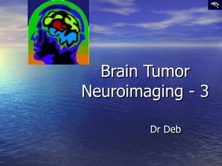Brain Tumor Neuroimaging - 3 Dr Deb 