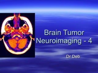 Brain Tumor Neuroimaging - 4 Dr Deb 