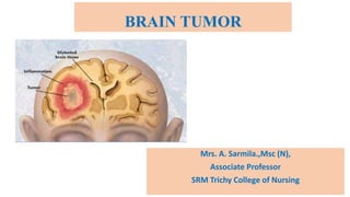 BRAIN TUMOR
Mrs. A. Sarmila.,Msc (N),
Associate Professor
SRM Trichy College of Nursing
 