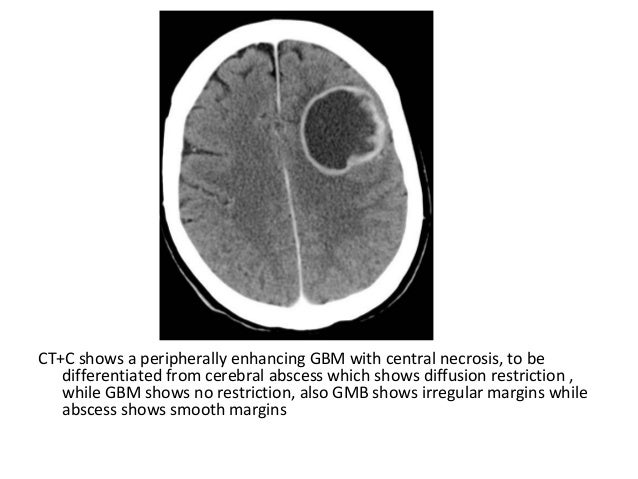 Diagnostic Imaging of Brain Tumors
