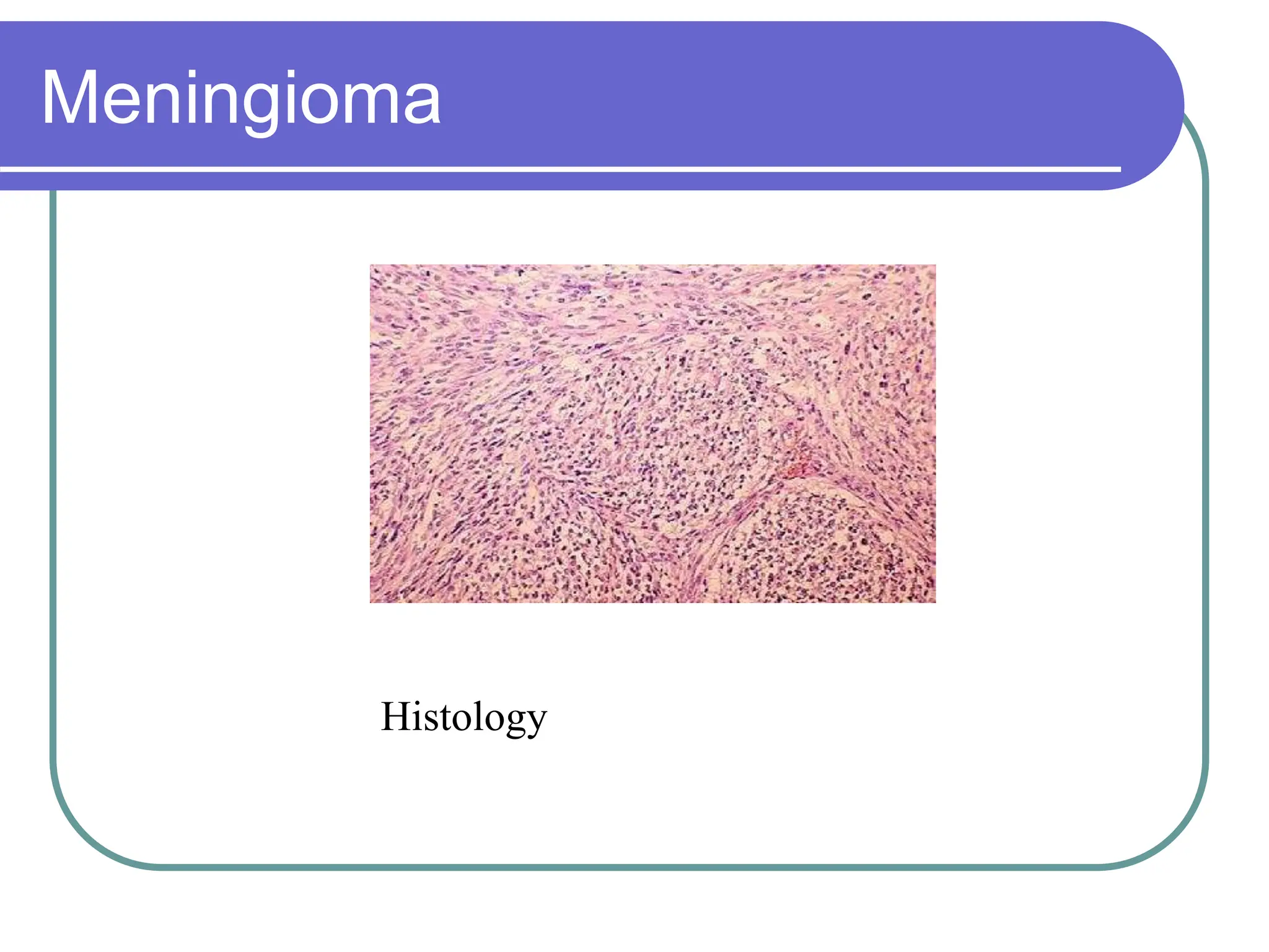 Brain Tumors Pathology and Management.ppt