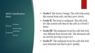 WHO Classification
Basis
u Increased
cellularity
u Nuclear atypia
u Endothelial
proliferation
u Necrosis
 