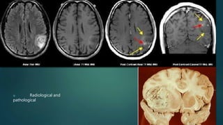 u Radiological and
pathological
 