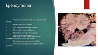 Ependymoma
u Arise from ependymal cells (an intraventricular
tumor)
u More common in children
u 10% pediatric intracranial tumors
u 5% of adult intracranial tumors
u Most common in the 4th ventricle
u Ataxia, vertigo, increased ICP
u May grow in brain parenchyma without
obvious
attachment to the ventricular system
u Spinal lesions more common in adults
u Intracranial ependymomas predominate in
children
 