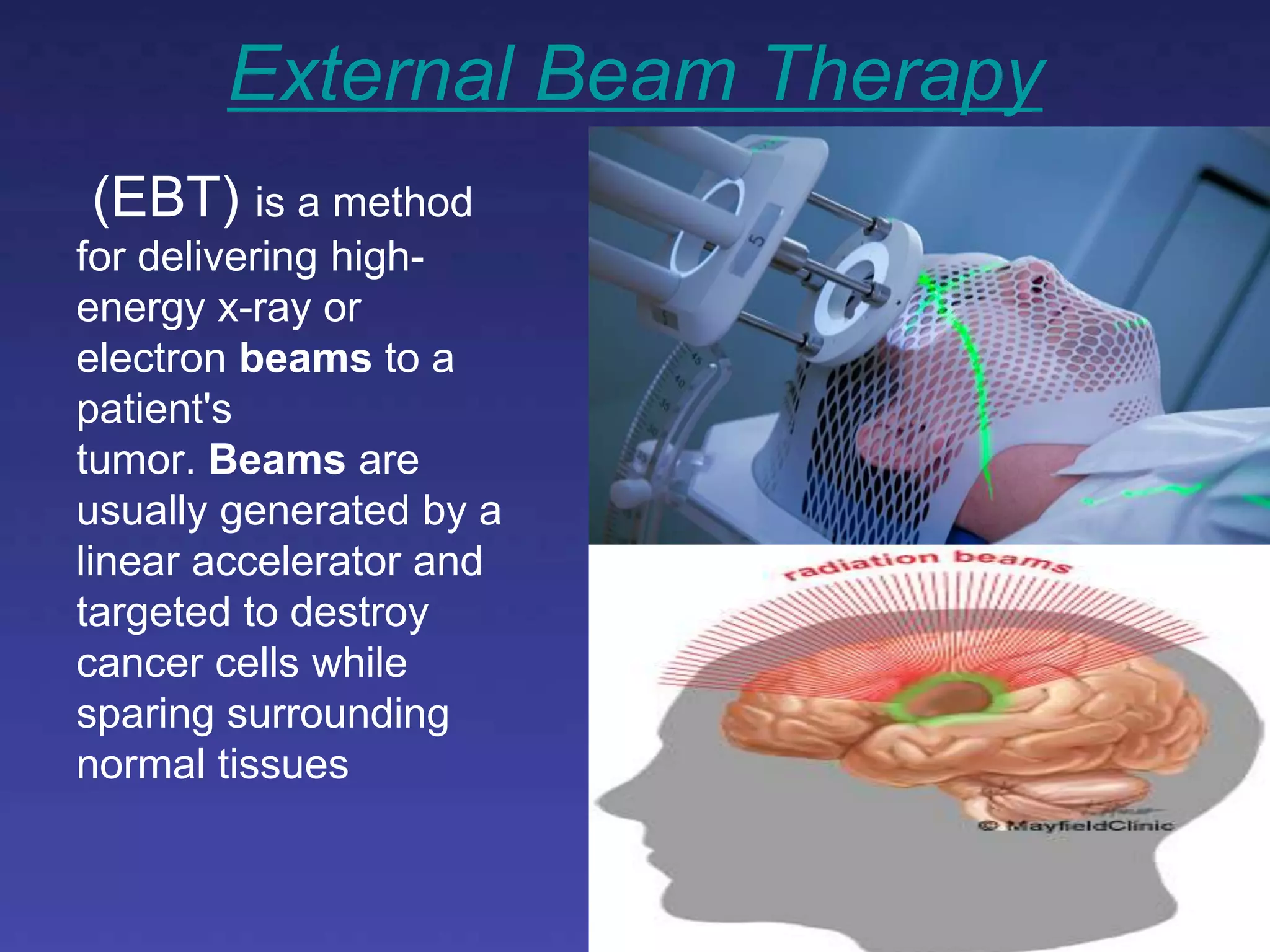 Brain tumors Radio diagnosis and therapy | PPTX