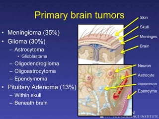 Brain tumors Radio diagnosis and therapy | PPTX