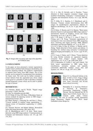 Brain tumor segmentation using asymmetry based histogram thresholding ...
