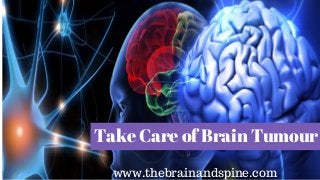 Take Care of Brain Tumour
www.thebrainandspine.com
 