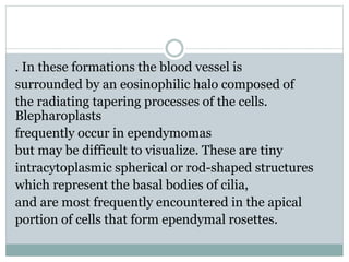 . In these formations the blood vessel is
surrounded by an eosinophilic halo composed of
the radiating tapering processes of the cells.
Blepharoplasts
frequently occur in ependymomas
but may be difficult to visualize. These are tiny
intracytoplasmic spherical or rod-shaped structures
which represent the basal bodies of cilia,
and are most frequently encountered in the apical
portion of cells that form ependymal rosettes.
 