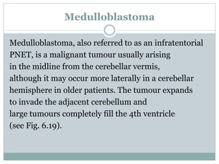 Medulloblastoma
Medulloblastoma, also referred to as an infratentorial
PNET, is a malignant tumour usually arising
in the midline from the cerebellar vermis,
although it may occur more laterally in a cerebellar
hemisphere in older patients. The tumour expands
to invade the adjacent cerebellum and
large tumours completely fill the 4th ventricle
(see Fig. 6.19).
 