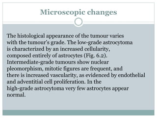Microscopic changes
The histological appearance of the tumour varies
with the tumour’s grade. The low-grade astrocytoma
is characterized by an increased cellularity,
composed entirely of astrocytes (Fig. 6.2).
Intermediate-grade tumours show nuclear
pleomorphism, mitotic figures are frequent, and
there is increased vascularity, as evidenced by endothelial
and adventitial cell proliferation. In the
high-grade astrocytoma very few astrocytes appear
normal.
 