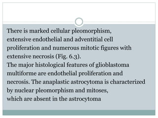 There is marked cellular pleomorphism,
extensive endothelial and adventitial cell
proliferation and numerous mitotic figures with
extensive necrosis (Fig. 6.3).
The major histological features of glioblastoma
multiforme are endothelial proliferation and
necrosis. The anaplastic astrocytoma is characterized
by nuclear pleomorphism and mitoses,
which are absent in the astrocytoma
 