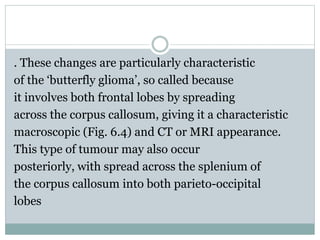 . These changes are particularly characteristic
of the ‘butterfly glioma’, so called because
it involves both frontal lobes by spreading
across the corpus callosum, giving it a characteristic
macroscopic (Fig. 6.4) and CT or MRI appearance.
This type of tumour may also occur
posteriorly, with spread across the splenium of
the corpus callosum into both parieto-occipital
lobes
 