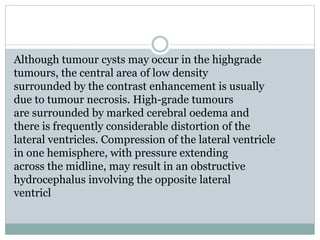 Although tumour cysts may occur in the highgrade
tumours, the central area of low density
surrounded by the contrast enhancement is usually
due to tumour necrosis. High-grade tumours
are surrounded by marked cerebral oedema and
there is frequently considerable distortion of the
lateral ventricles. Compression of the lateral ventricle
in one hemisphere, with pressure extending
across the midline, may result in an obstructive
hydrocephalus involving the opposite lateral
ventricl
 