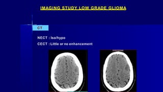 IMAGING STUDY LOW GRADE GLIOMA
CT
NECT : Iso/hypo
CECT : Little or no enhancement
 