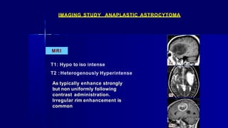 IMAGING STUDY ANAPLASTIC ASTROCYTOMA
MRI
T1: Hypo to iso intense
T2 : Heterogenously Hyperintense
As typically enhance strongly
but non uniformly following
contrast administration.
Irregular rim enhancement is
common
 