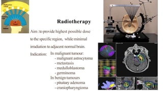 Radiotherapy
Aim :toprovide highest possible dose
tothe specificregion, while minimal
irradiation toadjacent normal brain.
Indication: In malignant tumour:
- malignant astrocytoma
- metastasis
- medulloblastoma
- germinoma
In benign tumours
- pituitary adenoma
- craniopharyngioma
 