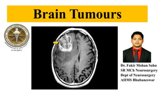 Brain Tumours
Dr. Fakir Mohan Sahu
SR MCh Neurosurgery
Dept of Neurosurgery
AIIMS Bhubaneswar
 
