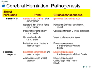 CNS TumorsCNS Tumors
Transtentorial herniation:
 Transtentorial herniation
at the base of the brain. A
prominent groove
surrounds the displaced
parahippocampal gyrus
(arrow). The adjacent 3rd
nerve (N) is compressed
and distorted and the
ipsilateral cerebral
peduncle (P) is distorted
with small areas of
haemorrhage.
 
