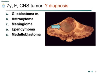 CNS TumorsCNS Tumors
Commonest Location of CNS tumor in Children?
1 2 3 4 5
4%
37%
4%
2%
53%
A.A. SupratentorialSupratentorial
B.B. CerebellumCerebellum
C.C. InfratentorialInfratentorial
D.D. Cerebrum.Cerebrum.
E.E. Brain stemBrain stem
 