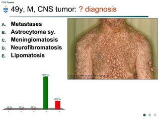 CNS TumorsCNS Tumors
56y, F Rapidly growing parietal lobe tumor:? diagnosis
1 2 3 4 5
88%
0%
6%6%
0%
A.A. Glioblastoma m.Glioblastoma m.
B.B. AstrocytomaAstrocytoma
C.C. MeningiomaMeningioma
D.D. EpendymomaEpendymoma
E.E. MedulloblastomaMedulloblastoma
 