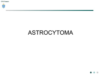 CNS TumorsCNS Tumors
35y Male, depression
Coronal T1 weighted MRI
Coronal T2 weighted MRI
 