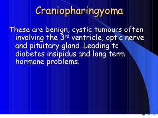 CNS TumorsCNS Tumors
 