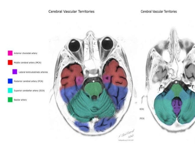Brain vascular anatomy with MRA and MRI correlation