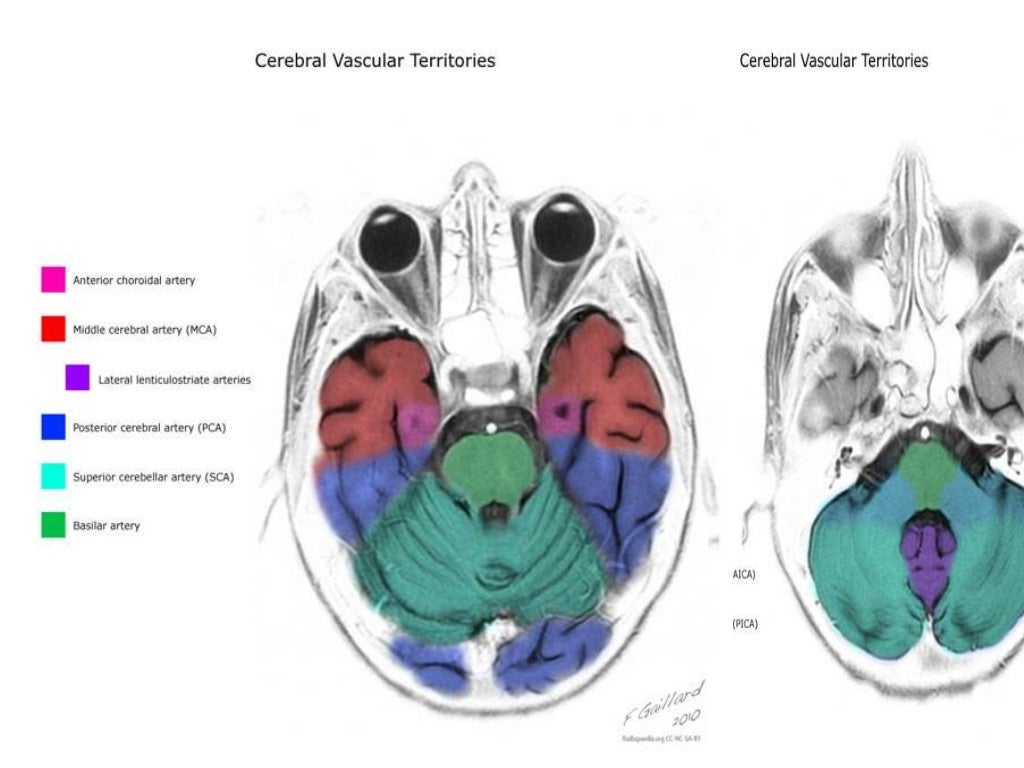 Brain vascular anatomy with MRA and MRI correlation