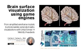 Brain surface
visualization
using game
engines
Fromsimplifiedwireframemodels
tophotorealisticextendedreality
visualizationswithUnity/Unreal → 
WebGL/headsets
Petteri Teikari, PhD
High-dimensionalNeurology,Queen’sSquareof
Neurology,UCL, London
https://www.linkedin.com/in/petteriteikari/
Version “14/12/20“
https://www.unrealengine.com/en-US/spotlights/helping-brain-surgeons-practice-with-real-time-simulation
https://www.vicarioussurgical.com/
 