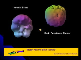 Normal Brain
Brain Substance Abuse
““Begin with the Brain in Mind”Begin with the Brain in Mind”
Donna Anderson and Tammy ReynoldsDonna Anderson and Tammy Reynolds
 
