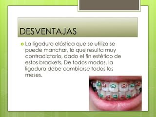 DESVENTAJAS
 La ligadura elástica que se utiliza se
puede manchar, lo que resulta muy
contradictorio, dado el fin estético de
estos brackets. De todos modos, la
ligadura debe cambiarse todos los
meses.
 