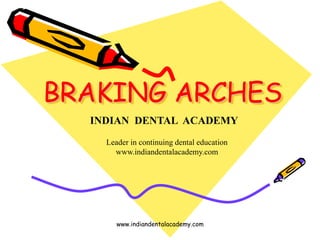 BRAKING ARCHES
www.indiandentalacademy.com
INDIAN DENTAL ACADEMY
Leader in continuing dental education
www.indiandentalacademy.com
 