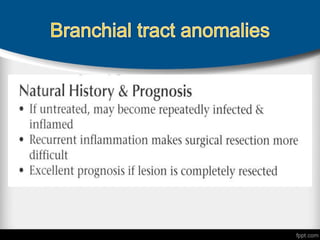 Branchial anomalies 