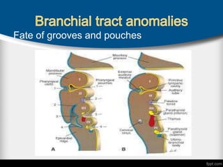 Fate of grooves and pouches
 