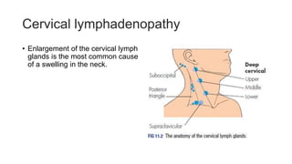 Cervical lymphadenopathy
• Enlargement of the cervical lymph
glands is the most common cause
of a swelling in the neck.
 