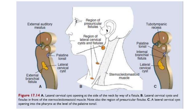 BRANCHIAL CYSTS et.pptx | Ear, Nose and Throat Conditions | Diseases ...