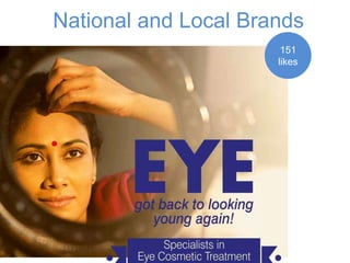 National and Local Brands 
151 
likes 
 