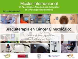 Braquiterapia en Cáncer Ginecológico
Mª Teresa Muñoz Migueláñez
Hospital Ramón y Cajal
 