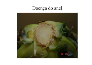 Doença do anel
 